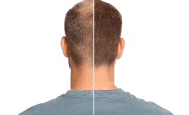 Visible Results within 2 months